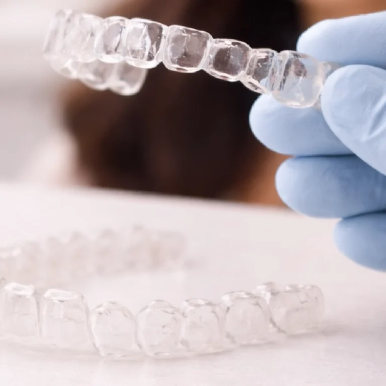 Clear Aligners
